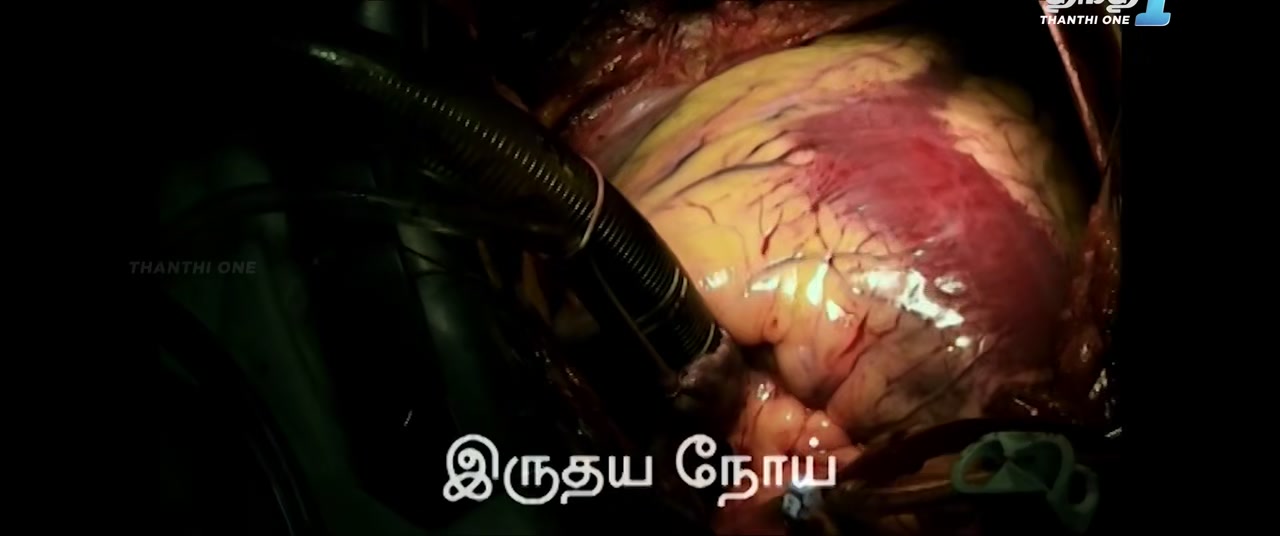 isaimini.Tube - Chitra Kadhai 2024 Original 720p HD (550MB).mp4